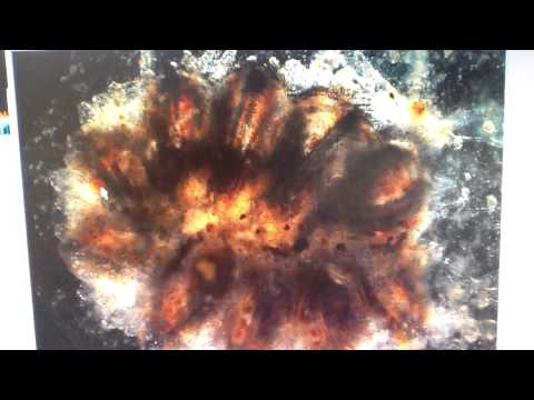 Carly Larsson - High School Stem Cell Research Intern Summer 2013, Video Project 2