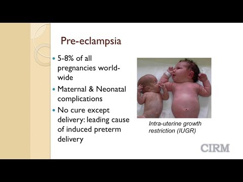Preeclampsia and Stem Cell Research: Mana Parast, UC-San Diego