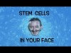 Stem Cells in Your Face: Treating ALS with a Disease in a Dish