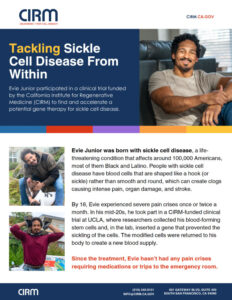 Flyer showcasing a Sickle Cell Disease clinical trial funded by CIRM.
